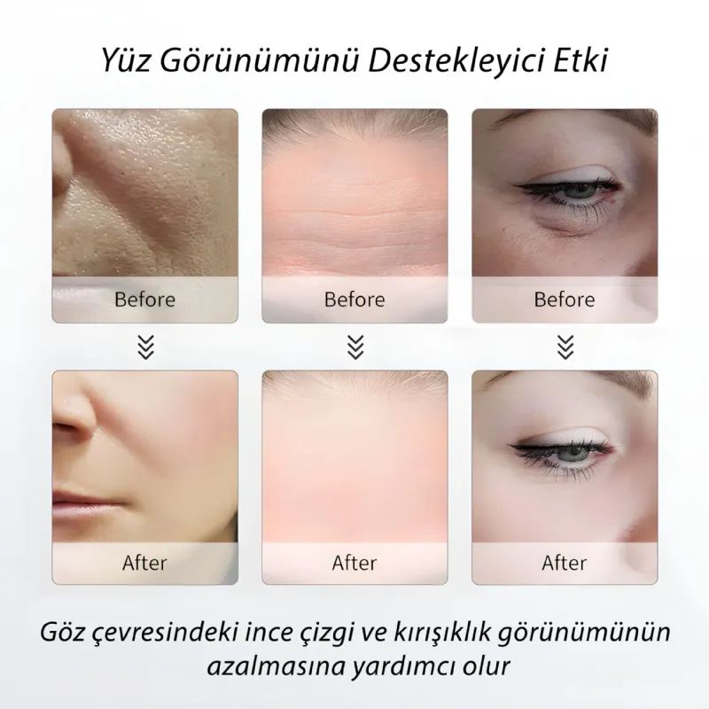 M2 K�r���kl� �nleyici