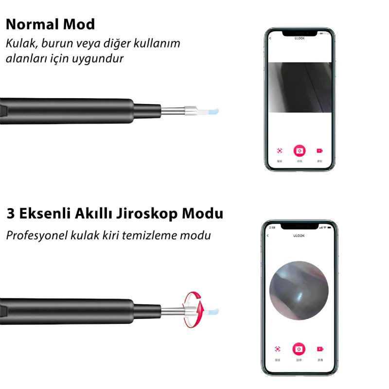 Tm-01 Kameral� Kulak Temizleme Kiti